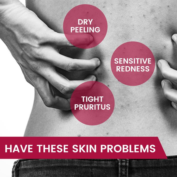 CeraVe Hydrocortisone Anti-Itch Cream – Soothes Irritation & Redness | 15g (0.5 oz)