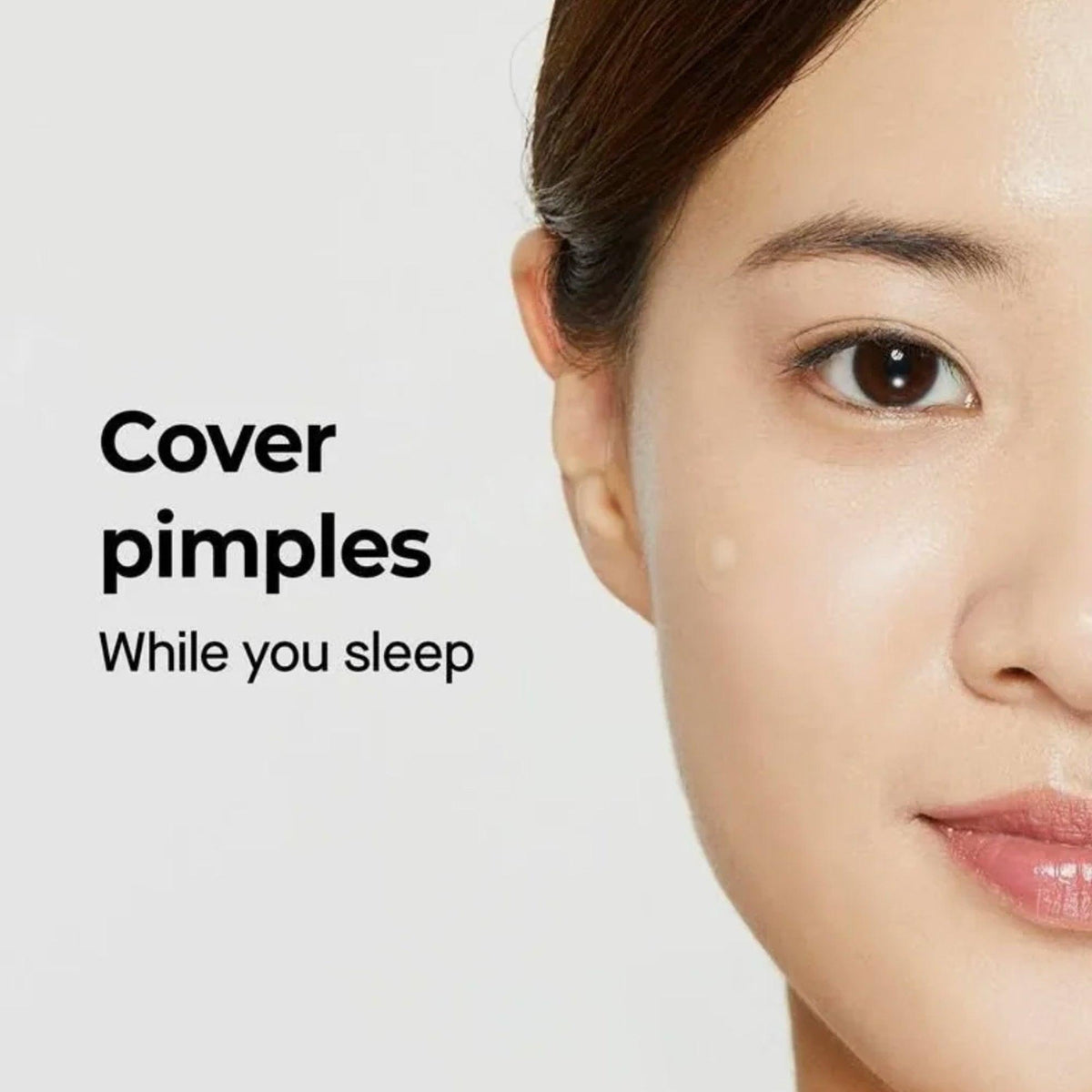 COSRX Acne Pimple Master Patch 24 Patches sheet with three sizes